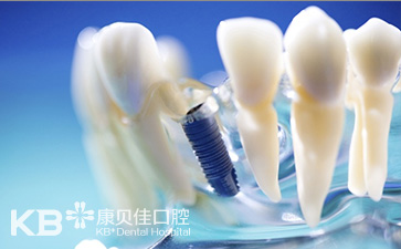 牙齿矫正有年龄限制吗